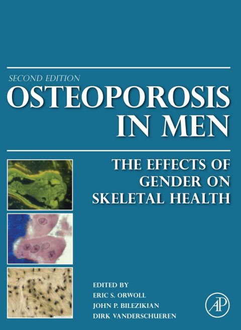 Osteoporosis in Men: The Effects of Gender on Skeletal Health, 2nd Edition - FULL INSTANT DOWNLOAD | PDF DOCX EPUB