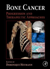 Cover image: Bone Cancer: Progression and Therapeutic Approaches 9780123748959