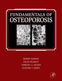 表紙画像: Fundamentals of Osteoporosis 9780123750983