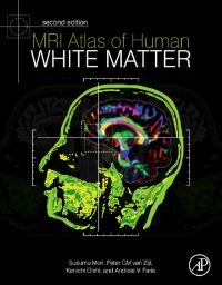 Immagine di copertina: MRI Atlas of Human White Matter 2nd edition 9780123820815