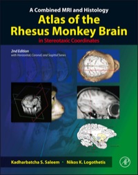 Immagine di copertina: A Combined MRI and Histology Atlas of the Rhesus Monkey Brain in Stereotaxic Coordinates 2nd edition 9780123850874
