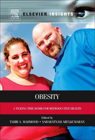 表紙画像: Obesity: A Ticking Time Bomb for Reproductive Health 9780124160453