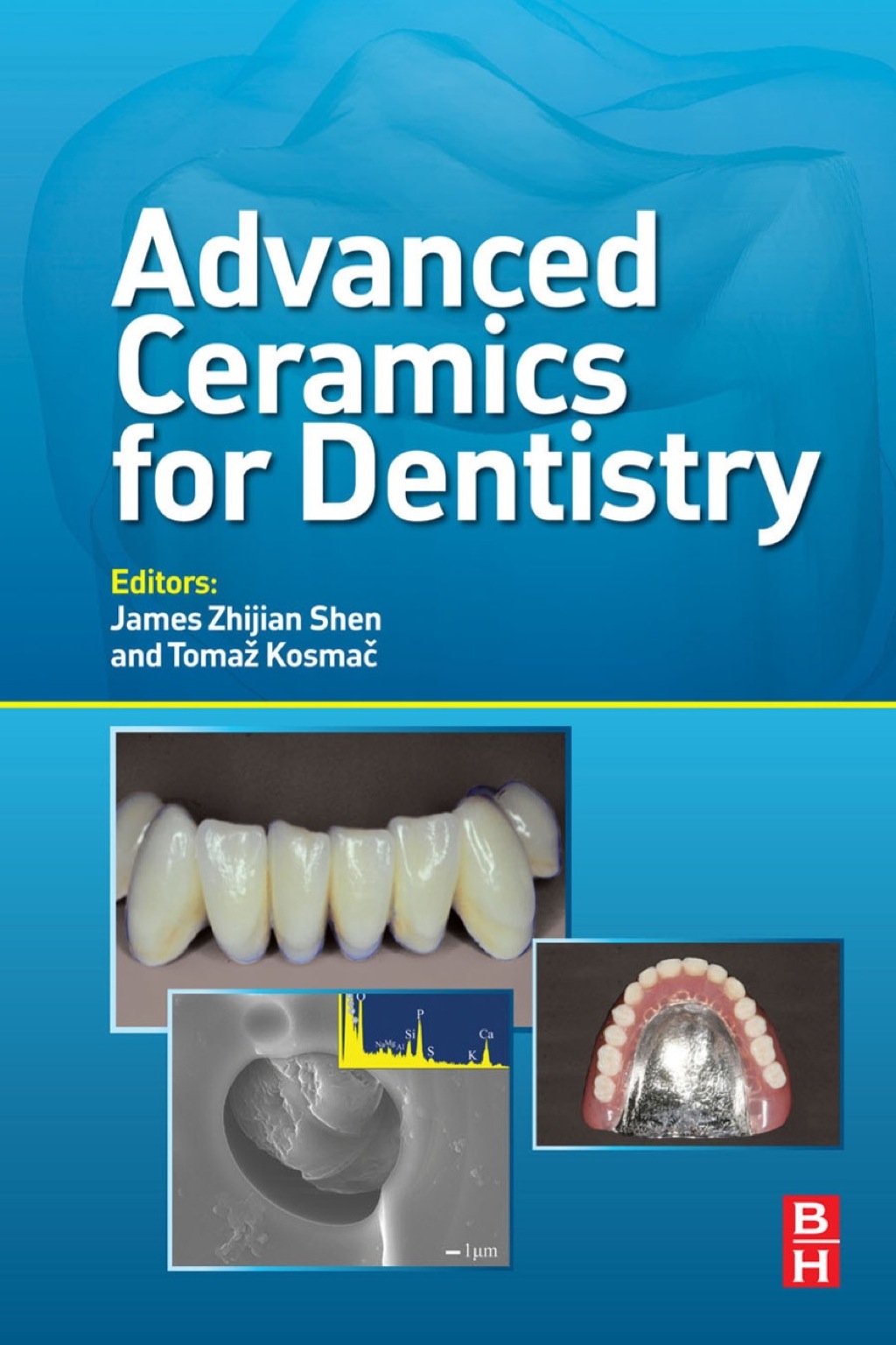 Advanced Ceramics for Dentistry