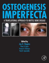 Imagen de portada: Osteogenesis Imperfecta: A Translational Approach to Brittle Bone Disease 9780123971654