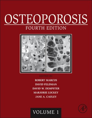 Immagine di copertina: Osteoporosis 4th edition 9780124158535