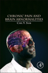 Omslagafbeelding: Chronic Pain and Brain Abnormalities 9780123983893