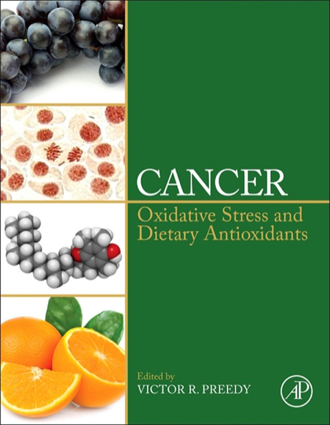Cancer: Oxidative Stress and Dietary Antioxidants - FULL INSTANT DOWNLOAD | PDF DOCX EPUB