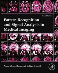 表紙画像: Pattern Recognition and Signal Analysis in Medical Imaging 2nd edition 9780124095458
