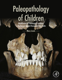 صورة الغلاف: Paleopathology of Children 9780124104020