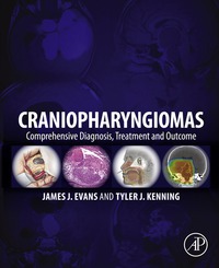 Cover image: Craniopharyngiomas: Comprehensive Diagnosis, Treatment and Outcome 9780124167063