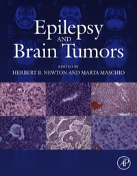 صورة الغلاف: Epilepsy and Brain Tumors 9780124170438