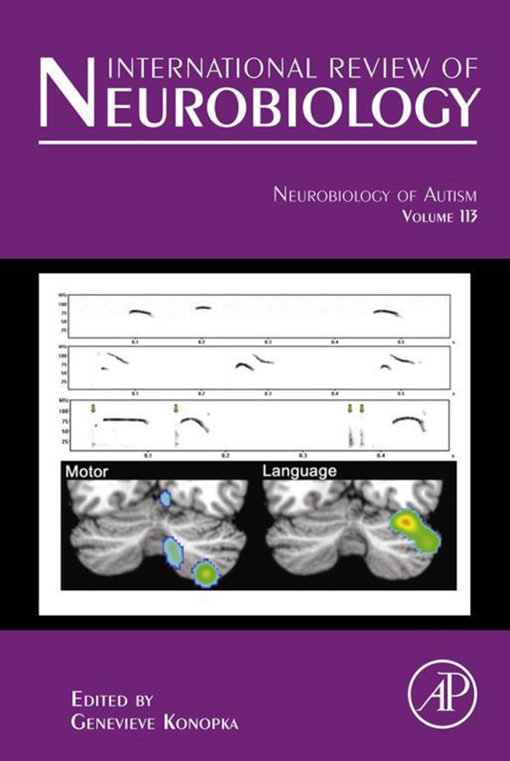 Neurobiology of Autism