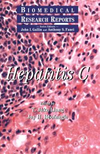 صورة الغلاف: Hepatitis C 9780124478701