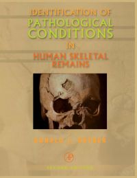 Omslagafbeelding: Identification of Pathological Conditions in Human Skeletal Remains 2nd edition 9780125286282