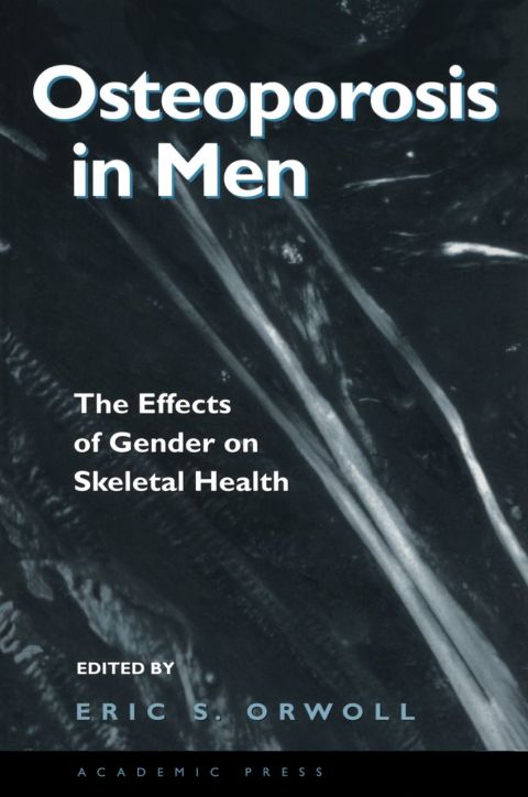 Osteoporosis in Men: The Effects of Gender on Skeletal Health - FULL INSTANT DOWNLOAD | PDF DOCX EPUB