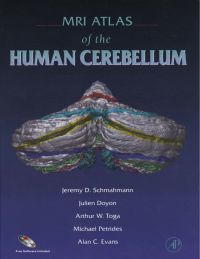 Titelbild: MRI Atlas of the Human Cerebellum 9780126256659