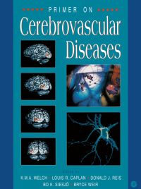 Titelbild: Primer on Cerebrovascular Diseases 9780127431703