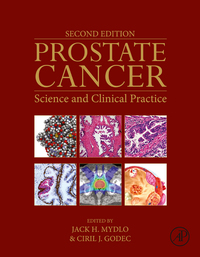 Cover image: Prostate Cancer 2nd edition 9780128000779