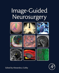 Cover image: Image-Guided Neurosurgery 9780128008706