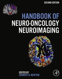 Titelbild: Handbook of Neuro-Oncology Neuroimaging 2nd edition 9780128009451