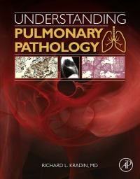 Omslagafbeelding: Understanding Pulmonary Pathology 9780128013045