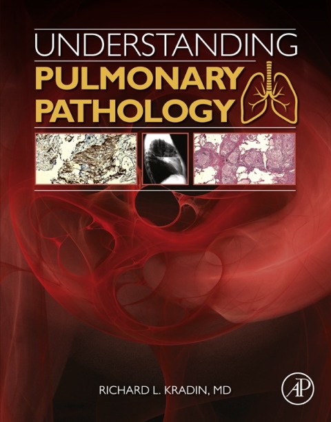 Understanding Pulmonary Pathology: Applying Pathological Findings in Therapeutic Decision Making - FULL INSTANT DOWNLOAD | PDF DOCX EPUB