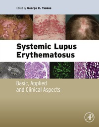 Omslagafbeelding: Systemic Lupus Erythematosus: Basic, Applied and Clinical Aspects 9780128019177