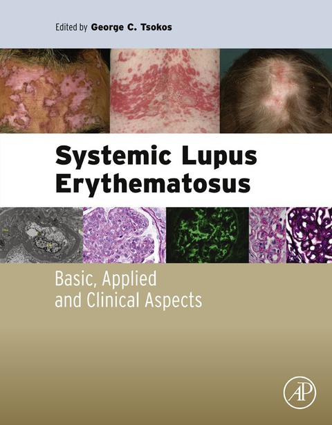 Systemic Lupus Erythematosus: Basic, Applied and Clinical Aspects - FULL INSTANT DOWNLOAD | PDF DOCX EPUB