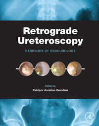 Omslagafbeelding: Retrograde Ureteroscopy: Handbook of Endourology 9780128024034