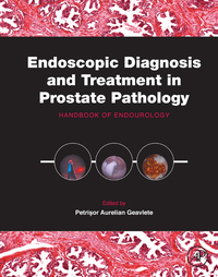 Cover image: Endoscopic Diagnosis and Treatment in Prostate Pathology: Handbook of Endourology 9780128024058