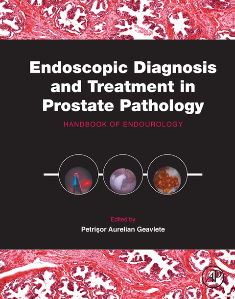 Endoscopic Diagnosis and Treatment in Prostate Pathology: Handbook of Endourology - FULL INSTANT DOWNLOAD | PDF DOCX EPUB