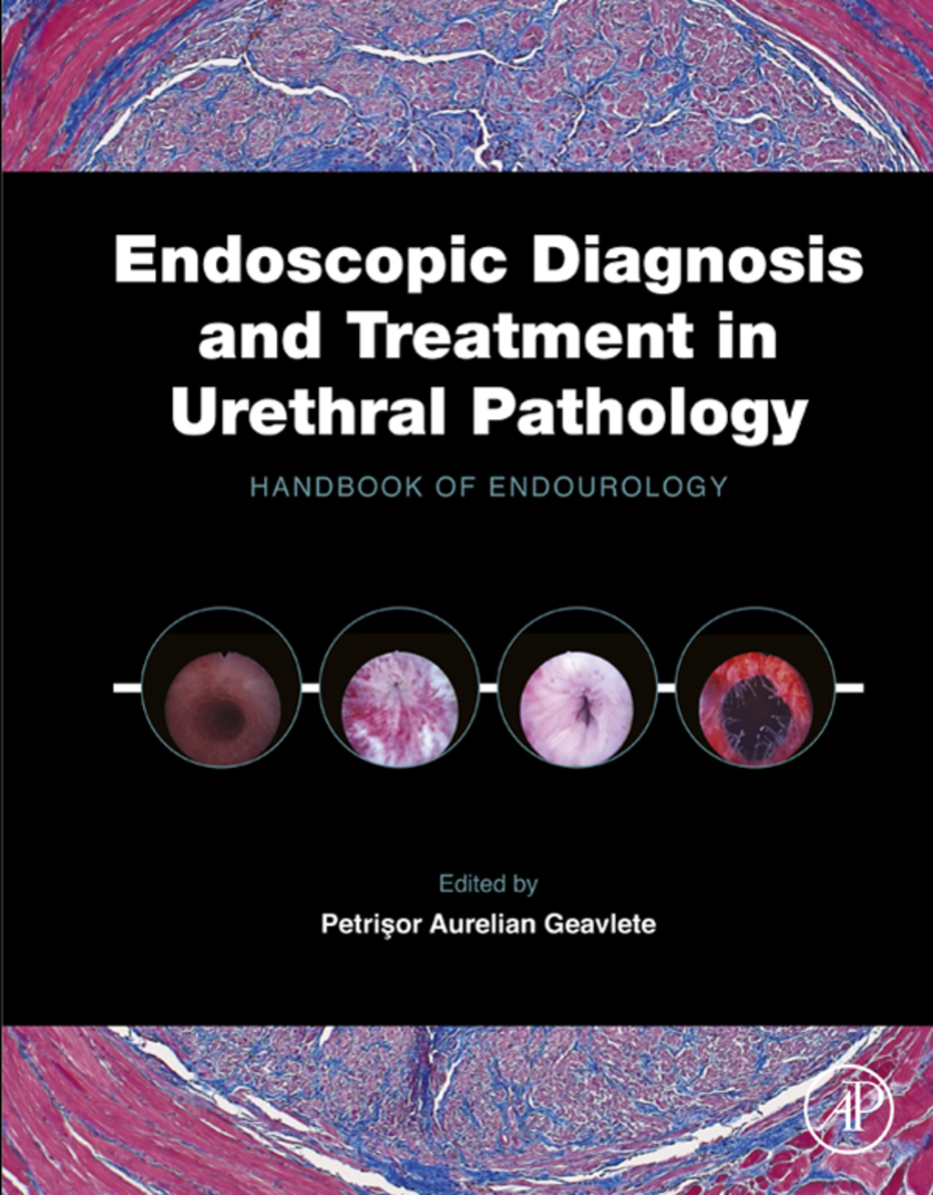 Endoscopic Diagnosis and Treatment in Urethral Pathology: Handbook of Endourology