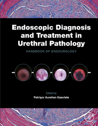 Imagen de portada: Endoscopic Diagnosis and Treatment in Urethral Pathology: Handbook of Endourology 9780128024065