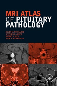 Titelbild: MRI Atlas of Pituitary Pathology 9780128025772