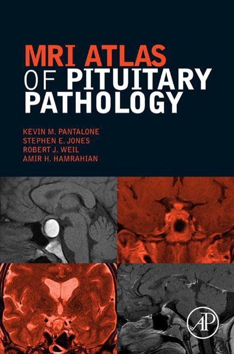 MRI Atlas of Pituitary Pathology - FULL INSTANT DOWNLOAD | PDF DOCX EPUB