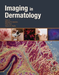 Titelbild: Imaging in Dermatology 9780128028384