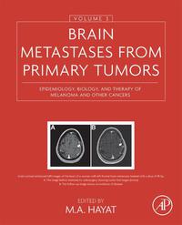表紙画像: Brain Metastases from Primary Tumors, Volume 3: Epidemiology, Biology, and Therapy of Melanoma and Other Cancers 9780128035085
