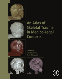 表紙画像: An Atlas of Skeletal Trauma in Medico-Legal Contexts 9780128037591