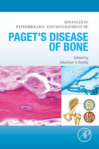 Imagen de portada: Advances in Pathobiology and Management of Paget’s Disease of Bone 9780128050835