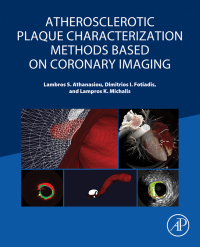 Titelbild: Atherosclerotic Plaque Characterization Methods Based on Coronary Imaging 9780128047347
