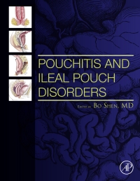 Immagine di copertina: Pouchitis and Ileal Pouch Disorders 9780128094020