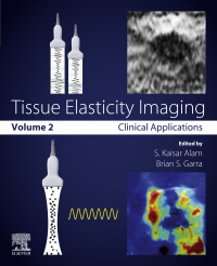 Cover image: Tissue Elasticity Imaging 9780128096628