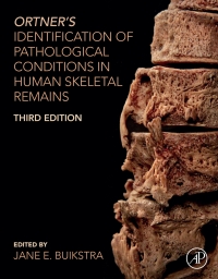 Imagen de portada: Ortner's Identification of Pathological Conditions in Human Skeletal Remains 3rd edition 9780123973115