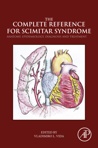 Immagine di copertina: The Complete Reference for Scimitar Syndrome 9780128104064