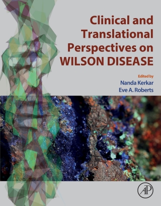 صورة الغلاف: Clinical and Translational Perspectives on WILSON DISEASE 9780128105320