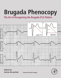 Cover image: Brugada Phenocopy 9780128111512