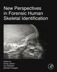 Cover image: New Perspectives in Forensic Human Skeletal Identification 9780128054291