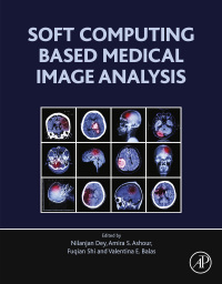 Omslagafbeelding: Soft Computing Based Medical Image Analysis 9780128130872
