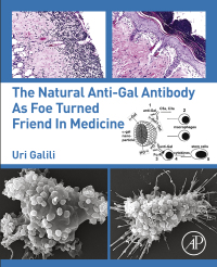 Imagen de portada: The Natural Anti-Gal Antibody as Foe Turned Friend in Medicine 9780128133620