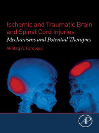 Imagen de portada: Ischemic and Traumatic Brain and Spinal Cord Injuries 9780128135969